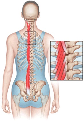 paraspinal-muscles